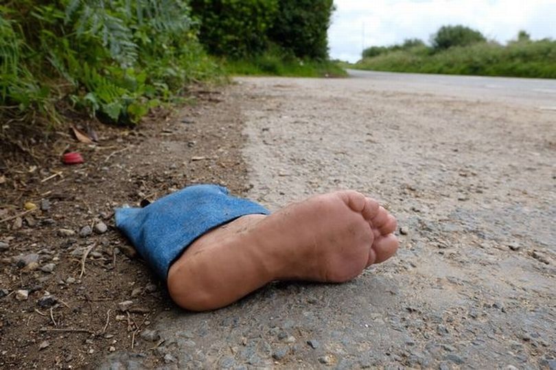 Kasus Misteri Kaki-Kaki Terputus – Misteri Mengguncang Dunia Kriminal