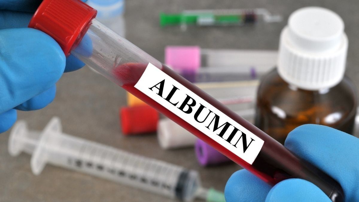 Albumin: Fungsi, Manfaat, dan Peran Penting dalam Tubuh